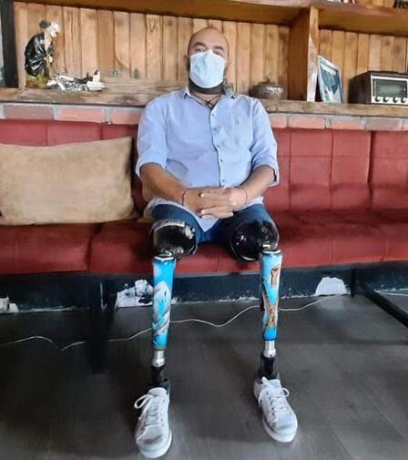17 Ağustos'ta iki bacağını kaybetti, depremzedelere destek için bölgeye gitti