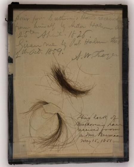 Beethoven’ının saç telleri incelenerek sağlığı hakkında bilgiler elde edildi
