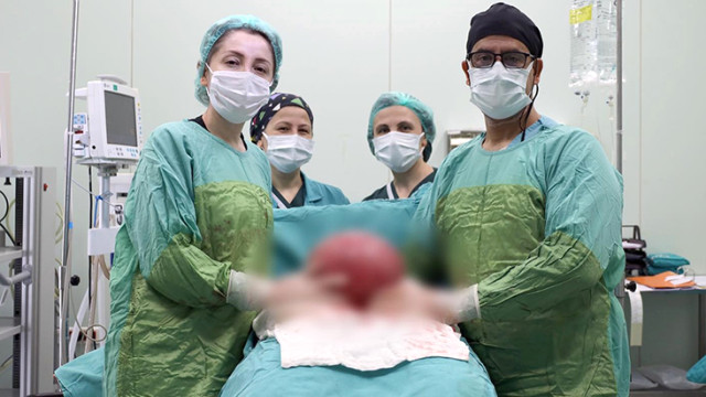 Şişlik nedeniyle hastaneye giden kadının karnından 3 kilo 750 gram ur çıktı