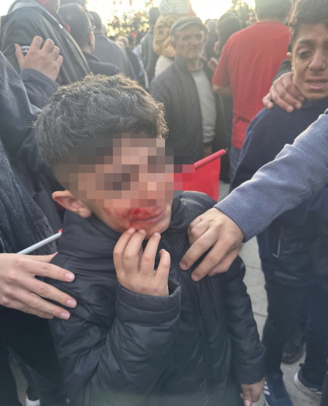 Erzurum'da İmamoğlu'nun mitingindeki vatandaşlara yapılan saldırının en net görüntüleri