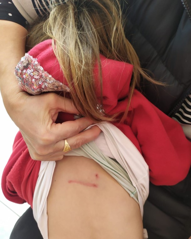 İzmit'te başıboş sokak köpekleri anne kıza saldırdı! Belediye başkanına dava açacaklar