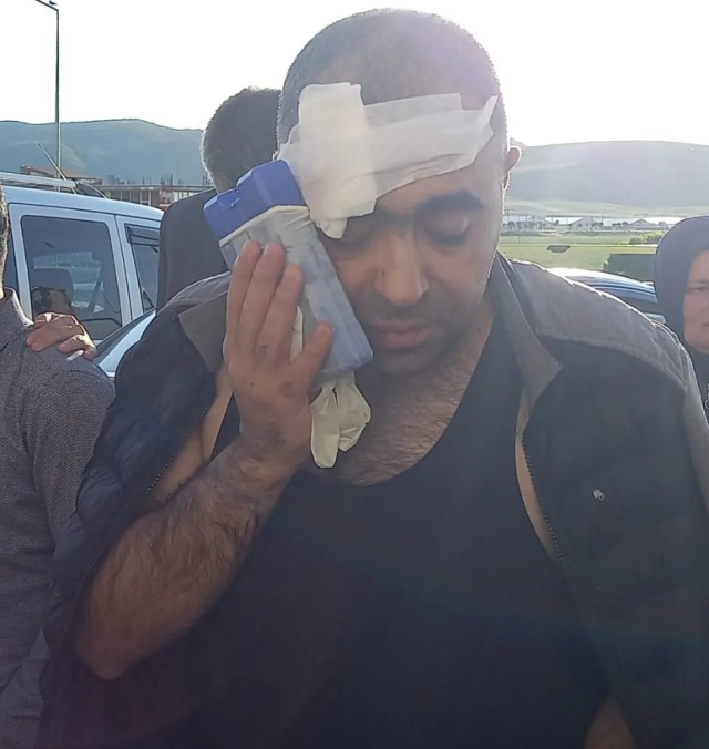 Belediye başkanının korumalarının tekme tokat dövdüğü gazeteci Sinan Aygül'den ilk sözler: Bu işin peşini bırakmayacağım