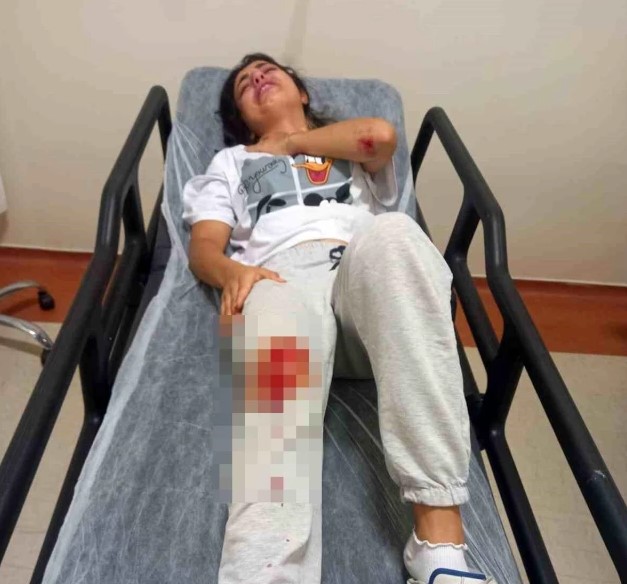 Kastamonu'da başıboş sokak köpeklerinin saldırdığı kadın hastanelik oldu