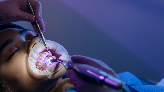 Protetik diş tedavisi nedir, neye bakar? Kullanılan protezler ve uygulama yöntemleri hakkında bilgi