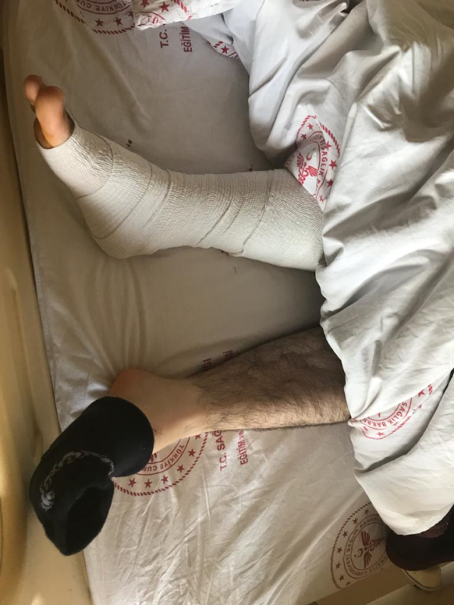 Operasyondan çıkan hasta kendine gelince hayatının şokunu yaşadı: Yanlış ayağımı ameliyat ettiler