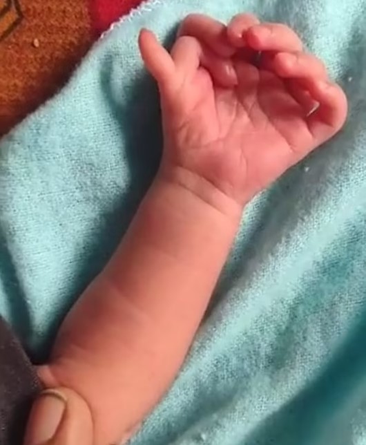 Hindistan'da 26 parmakla dünyaya gelen bebek yerel halk tarafından tanrıça kabul edildi