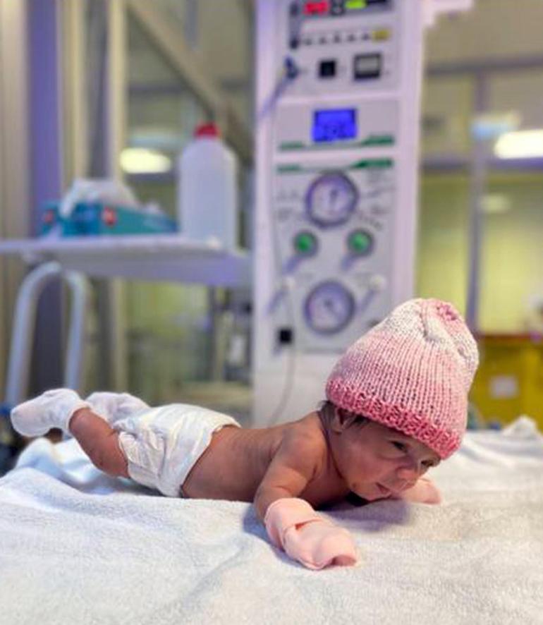 515 gram doğan Elif bebek, 98 günlük tedavi sonrası hayata tutundu