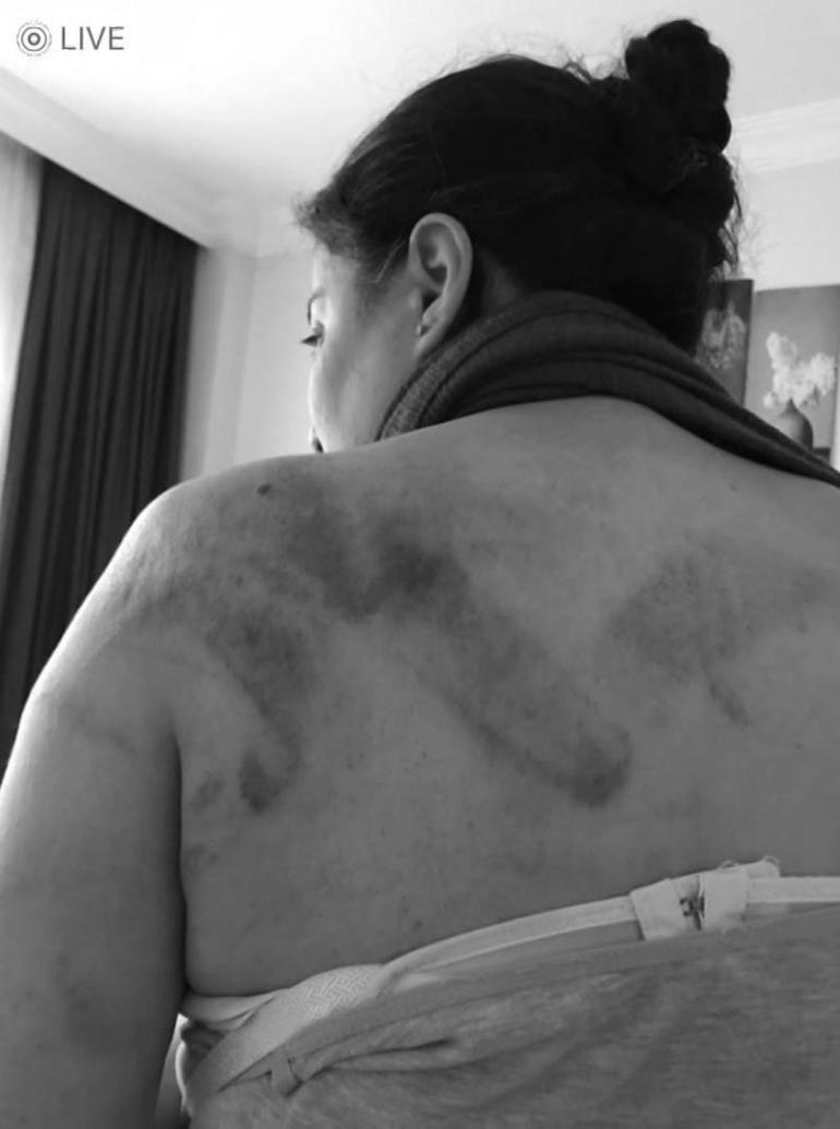Bağcılar'da eski eşinin ailesi tarafından sokak ortasında dövülen kadının yardım çağrısı