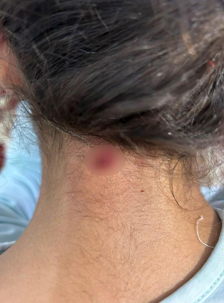 Bahçelievler'de maganda kurşunu 11 yaşındaki kızın boynuna isabet etti