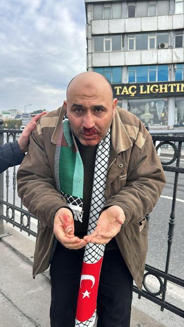 Filistin'e destek yürüyüşündeki vatandaşa yumruklu saldırı: Şüpheli gözaltına alındı