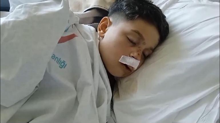 Sultangazi'de 2 kişinin tahterevalliden düşürdüğü çocuk ağır yaralandı