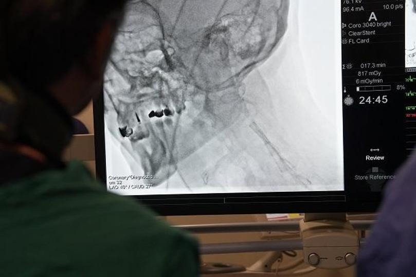 Türk doktorlar, ileri stent teknikleriyle betonlaşmış damarları açmayı öğretti